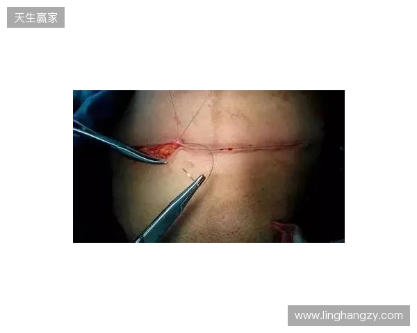 广州豹官方：杨浩眉弓伤口缝合30余针，预计5-7天后拆线